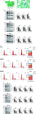 Integrating network pharmacology, molecular docking and experimental verification to reveal the mechanism of artesunate in inhibiting choroidal melanoma